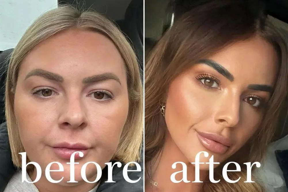 Only Looksmax user before and after