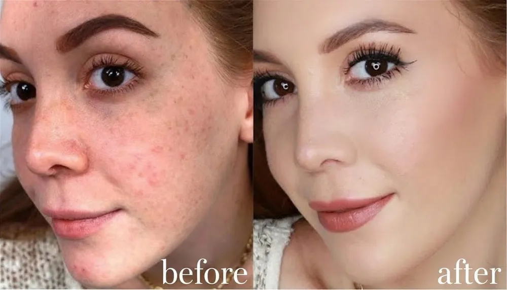 Only Looksmax user before and after