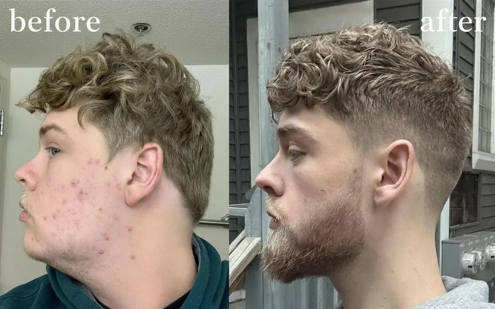 Only Looksmax user before and after