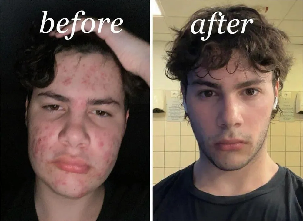 Only Looksmax user before and after